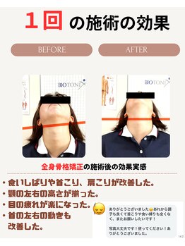 クローバー鍼灸整骨院/全身骨格矯正の一回の効果