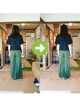 サプライズ整体院/30代ママさんの産後の骨盤初回