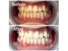 シャイニング 岩出店(SHINING)の雰囲気（ご家族やお友達と一緒にホワイトニングを受けることもできます♪）