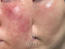 ボーテスキンクリニックの雰囲気（ホームケアのみでも変化を実感◎）