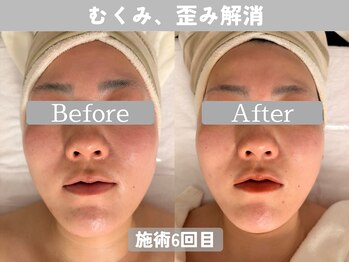 ミピマム 町田店/むくみ、歪みを根本改善！