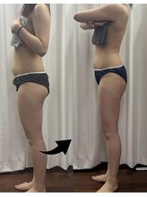 ラサロンホープ 西麻布(La.SALON HOPE)/横から見たラインの薄さが明らか