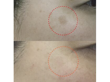 ラヴィアンローズ(La vie en Rose)の写真