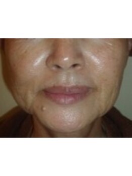 ハリツヤをUPしたい