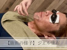 メンズプラス(MEN’S PLUS)/ヒゲ脱毛/施術風景