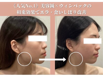 ミプラス鍼灸スタジオの写真