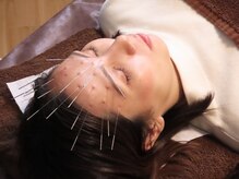 リサ鍼灸院(RISA鍼灸院)