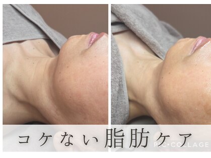 アルム(Areum)の写真