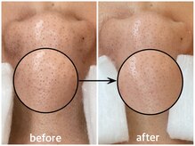 毛穴専科/毛穴洗浄+白玉ワックス メンズ◎