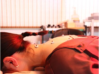 心鍼一如はりきゅう整骨院/【肩】お灸施術