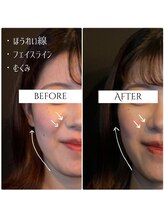 クク 赤坂 天神(99 KUKU)/【ほうれい線】【むくみ】