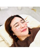 銀座鍼処 カナウ(KANAU)/ギュインとリフトアップ美容鍼♪