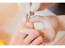 ドクターネイル爪革命 姫路店の雰囲気（自宅でできるケアも伝授いたします！【フットケア/巻き爪】）