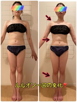 ヨサパーク エスポワール 三木店(YOSAPARK Espoir)の写真/【最短痩せ】厳選ハーブのよもぎ蒸し×リンパマッサージで滝汗効果絶大!1人1人に合った施術で徹底サポート