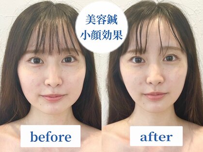 ラ カルナベル(La Carnabel)の写真
