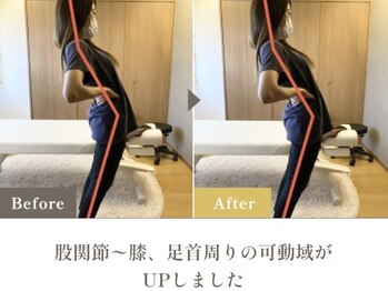 整体 寿 横浜院(KOTOBUKI)/横浜/横浜市/整体/肩こり