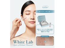 アルッカ(Arukka)