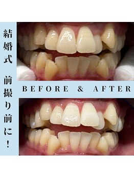 ドルチェ 水戸店(Dolce)/★ before → after ★