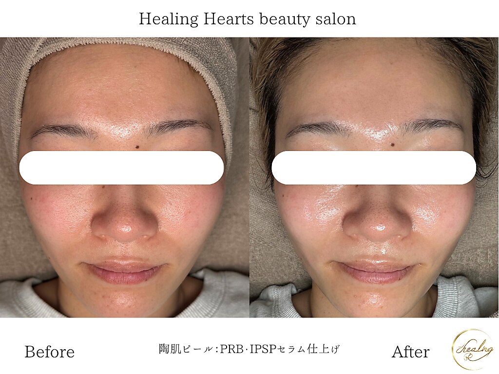 ヒーリングハーツ(Healing Hearts)｜ホットペッパービューティー