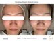 ヒーリングハーツ(Healing Hearts)の写真