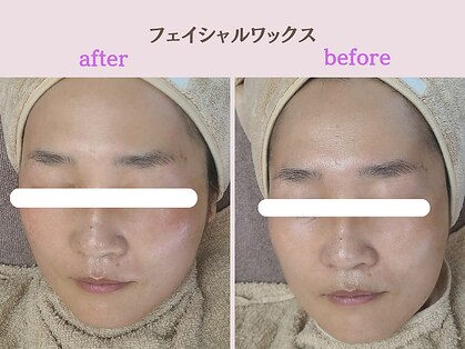 まつげや いちじくの写真