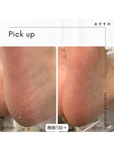 ラパン(Lapin)/ガチガチかかともツヤツヤへ