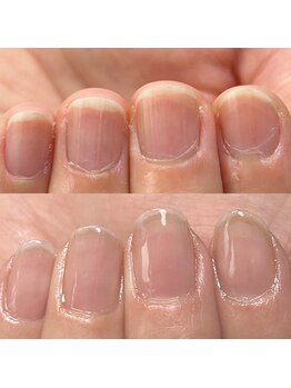 ハッチネイル(HACCI nail)/お客様　before after