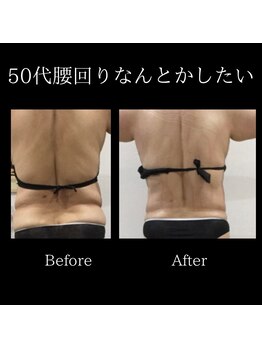 レミュー/レミューダイエット症例