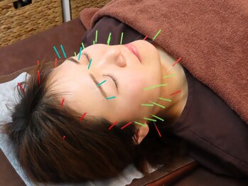いとう鍼灸整体院 代官山恵比寿の写真/普段頑張っている自分の身体をいたわりませんか？【昨日とは別人のようなすっきり感】美容鍼でも◎