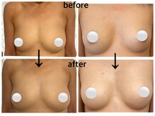 エステ越えのバストアップが叶う！