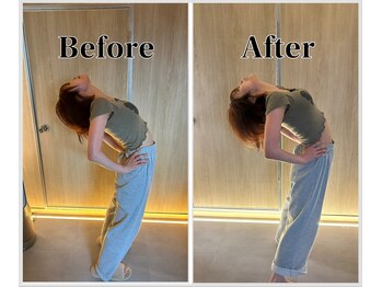 整体ラルース 中目黒(LALUZ)/20代 女性 猫背、巻き肩改善