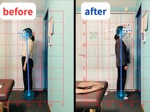 オンリー整体院(ONLY整体院)/befre aftter【桂　整体】