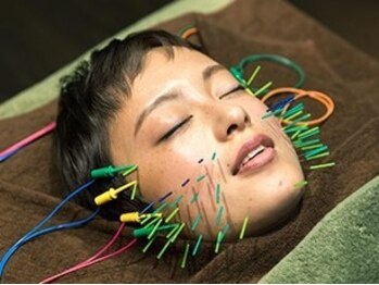 ビーカラット(B/CARAT)の写真/【美しいフェイスラインへ導く小顔美容鍼】エステや化粧品ではケア出来ないお肌の深部までアプローチ！