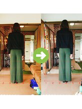 サプライズ整体院/30代ママさんの産後の骨盤初回