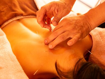 サロンラメール(Salon Lamer)の写真/カップルで通いたい！美容鍼で自律神経、全身鍼灸で巡りをサポート！キレイを一緒に目指そう☆（40文字）