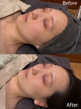 美肌研究所 絹 田辺店/一度でくすみ改善透明感UP♪