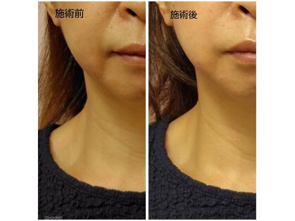サロンモンチ(Salon_monchi)の写真