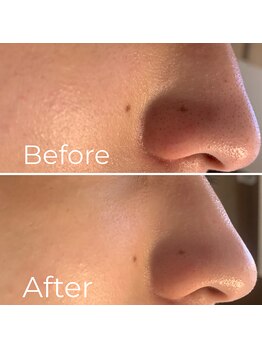 ウエカ(ueka)/つるんとした肌