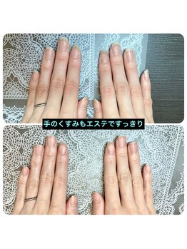 桃の木 吉祥寺店/ビフォーアフター くすみケア