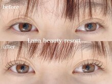 ラナビューティリゾート(Lana Beauty resort)/アップラッシュリフト