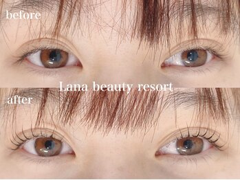 ラナビューティリゾート(Lana Beauty resort)/アップラッシュリフト