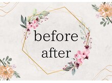 ヨサパーク ハーブ Melody亀山店(YOSA PARK)/痩身/ダイエット/リンパ/産後