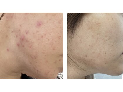 ブロン(Blanc)の写真