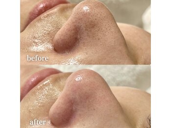 エクレ(eclat)/毛穴レス肌