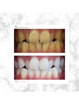 ホワイト 上乃木南店(WHITE)/ビフォーアフター