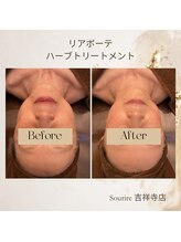 スリール 吉祥寺店(Sourire)/リアボーテハーブトリートメント