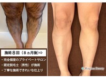 レジーナビューティー(Regina Beauty)の雰囲気（太もも上～足指先まで初回9980円、２回目以降12000円（都度払い)）