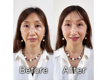 プリップ 中目黒(Pulip)/【50代お客様】ビフォーアフター