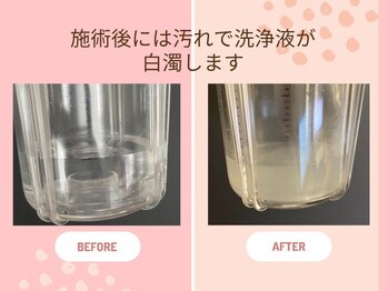 フェスティナ レンテ(Festina Lente)/見える毛穴汚れの証拠！