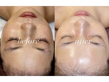 レシェルサロン(Lechelle Salon)/ダクトピール